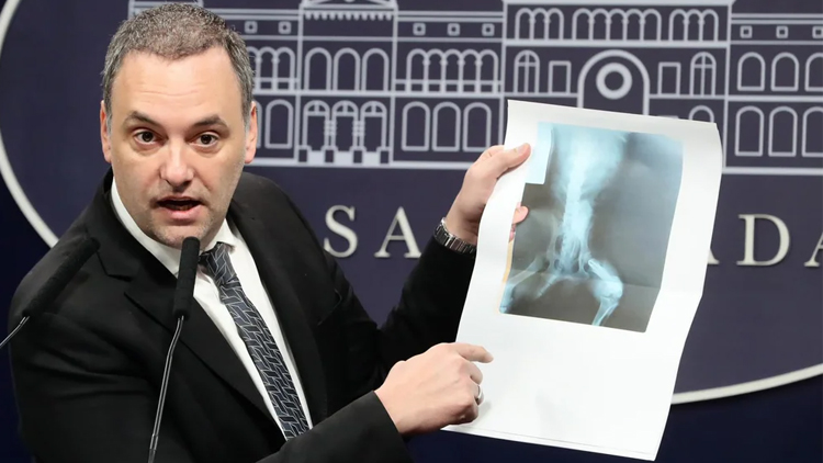 POLÍTICA: El Gobierno denunció un esquema de corrupción en la Agencia Nacional de Discapacidad que desvió USD 3.400 millones