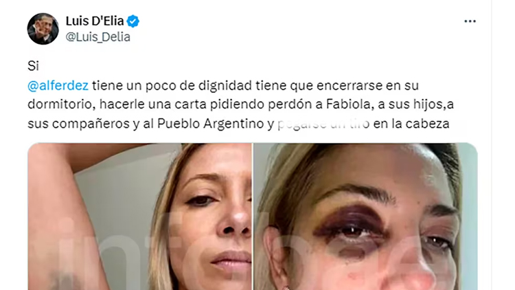 JUDICIALES: Denunciaron a Luis D´Elia por instigar el suicidio de Alberto Fernández