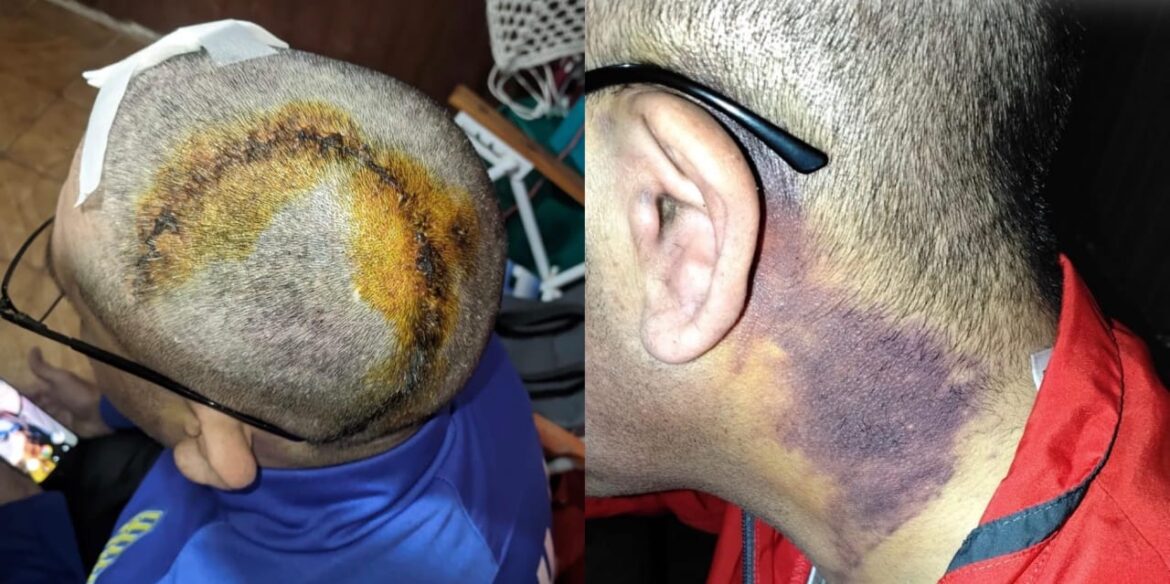 Brutal paliza en Naschel: 40 días más de cárcel para dos jóvenes que casi matan a un hombre